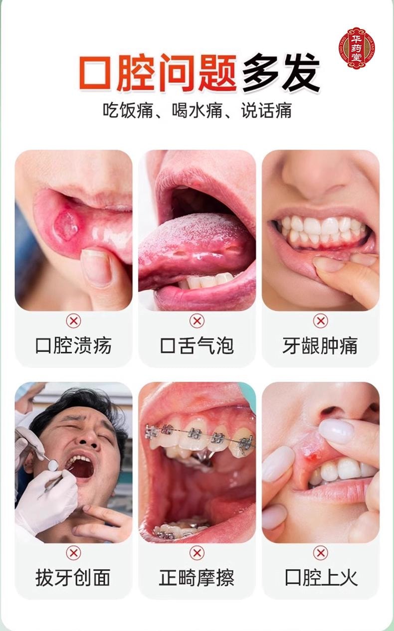 三金桂林西瓜霜 桂林三金  清热解毒 消肿止痛 用于咽喉肿痛 口舌生疮 牙龈肿痛 口腔炎 口腔溃疡3.0g*1btl